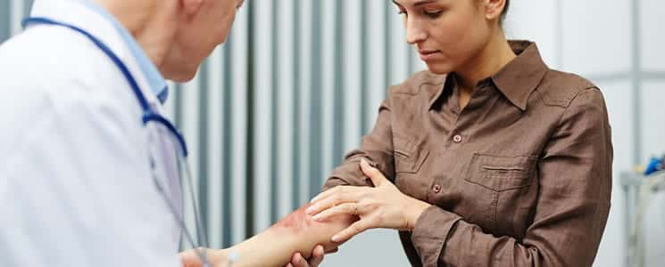 Eczema Treatment Dallas TX
