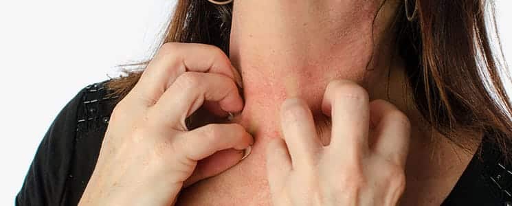 Skin Allergies Treatment Dallas TX