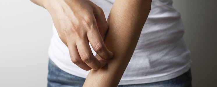 Dermatitis Treatment Dallas TX