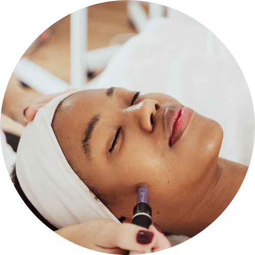 Microneedling